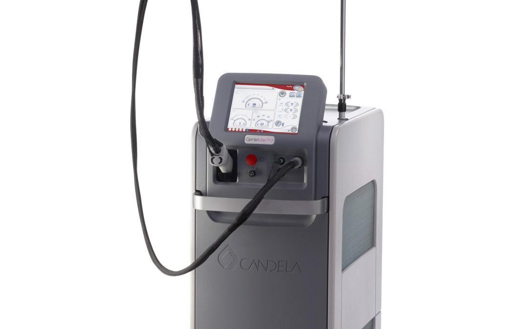 Laser hair removal questions answered!