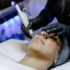 MicroNeedling Decollete